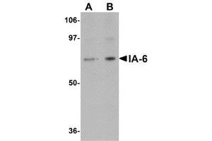 Western blot analysis of IA-6 in rat thymus tissue lysate with AP30397PU-N IA-6 antibody at (A) 1 and (B) 2 μg/ml. (INSM2 anticorps  (C-Term))