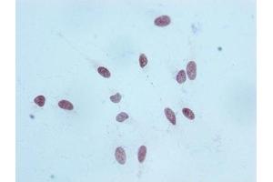 Immunocytochemistry analysis of ABIN7127300 diluted at 1:100 and staining in Hela cells performed on a Leica BondTM system. (Recombinant Histone H3.1 anticorps  (H3K18me1))