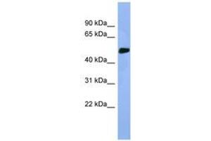 Image no. 1 for anti-serine/threonine Kinase 25 (STK25) (AA 274-323) antibody (ABIN6746292) (STK25 anticorps  (AA 274-323))