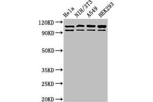 Western Blot Positive WB detected in: Hela whole cell lysate, NIH/3T3 whole cell lysate, A549 whole cell lysate, HEK293 whole cell lysate All lanes: MSH2 antibody at 2 μg/mL Secondary Goat polyclonal to rabbit IgG at 1/50000 dilution Predicted band size: 105, 98 kDa Observed band size: 105, 98 kDa (MSH2 anticorps  (AA 2-254))