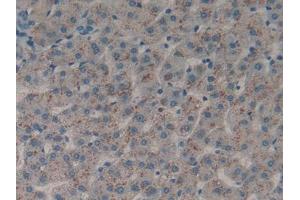 DAB staining on IHC-P; Samples: Human Liver Tissue (DDR1 anticorps  (AA 568-829))