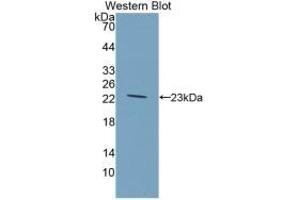 Detection of Recombinant GKRP, Rat using Monoclonal Antibody to Glucokinase Regulatory Protein (GKRP) (GCKR anticorps  (AA 90-286))
