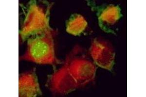 Immunofluorescence (IF) image for anti-Herpes Simplex Virus Type 1 ICP0 (HSV1 ICP0) antibody (ABIN265560) (HSV1 ICP0 anticorps)