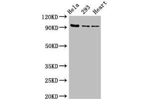 Western Blot Positive WB detected in: Hela whole cell lysate, 293 whole cell lysate, Rat heart tissue All lanes: MCM4 antibody at 2. (MCM4 anticorps  (AA 2-141))