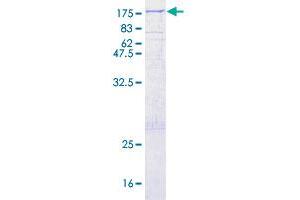 Image no. 1 for Thyroid Peroxidase (TPO) (AA 1-933) protein (GST tag) (ABIN1323443)