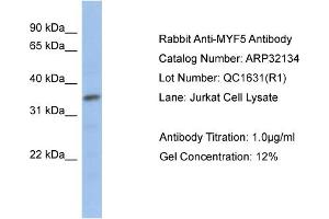 Western Blotting (WB) image for anti-Myogenic Factor 5 (MYF5) (N-Term) antibody (ABIN182493) (MYF5 anticorps  (N-Term))