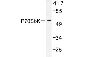 Image no. 1 for anti-Ribosomal Protein S6 Kinase, 70kDa, Polypeptide 1 (RPS6KB1) antibody (ABIN272051) (RPS6KB1 anticorps)