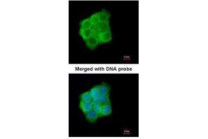 ICC/IF Image Immunofluorescence analysis of paraformaldehyde-fixed A431, using Cytokeratin 13, antibody at 1:200 dilution. (Cytokeratin 13 anticorps)