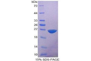 SDS-PAGE (SDS) image for Interleukin 1 delta (FIL1d) (AA 1-156) protein (His tag) (ABIN2125427)