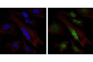 Immunofluorescence analysis of Hela cells using SOX9 antibody (green). (SOX9 anticorps)