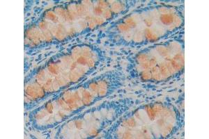 Used in DAB staining on fromalin fixed paraffin- embedded Kidney tissue