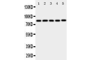 Western Blotting (WB) image for anti-X-Ray Repair Complementing Defective Repair in Chinese Hamster Cells 5 (Double-Strand-Break Rejoining) (XRCC5) (AA 648-662), (C-Term) antibody (ABIN3044235)