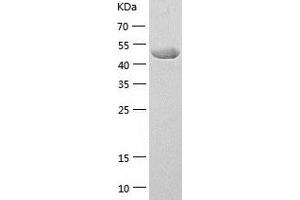 Western Blotting (WB) image for Forkhead Box D3 (FOXD3) (AA 2-478) protein (His tag) (ABIN7122992) (FOXD3 Protein (AA 2-478) (His tag))