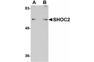 Image no. 1 for anti-Leucine-rich repeat protein SHOC-2 (SHOC2) (N-Term) antibody (ABIN478033) (SHoc2/Sur8 anticorps  (N-Term))