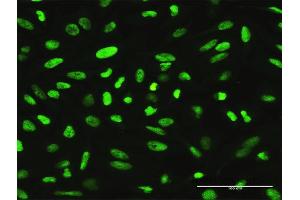 Immunofluorescence of purified MaxPab antibody to XRCC1 on HeLa cell.