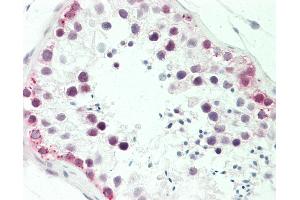 Anti-MTA1 antibody IHC staining of human testis. (MTA1 anticorps  (AA 400-450))