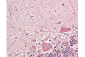 Human Brain, Cerebellum: Formalin-Fixed, Paraffin-Embedded (FFPE).