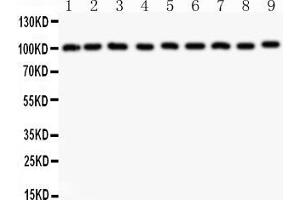 Anti-CBL Picoband antibody, All lanes: Anti-CBL at 0. (CBL anticorps  (AA 556-906))