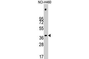 Western blot analysis of PDHX polyclonal antibody  in NCI-H460 cell line lysates (35 ug/lane). (PDHX anticorps  (Thr11))