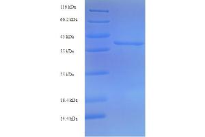 SDS-PAGE (SDS) image for Receptor (TNFRSF)-Interacting serine-threonine Kinase 1 (RIPK1) (AA 24-247), (partial) protein (His-SUMO Tag) (ABIN5710918)