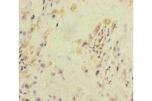 Immunohistochemistry of paraffin-embedded human placenta tissue using ABIN7157289 at dilution of 1:100 (KLHL26 anticorps  (AA 366-615))