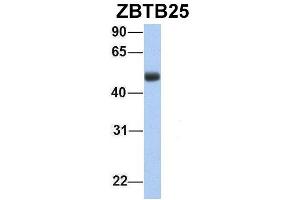 Host:  Rabbit  Target Name:  ZBTB25  Sample Type:  Human Fetal Lung  Antibody Dilution:  1. (ZBTB25 anticorps  (Middle Region))