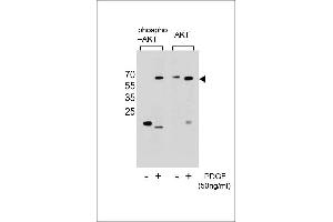 Western blot analysis of extracts from NIH-3T3 cells,untreated or treated with PDGF,using Phospho-Akt(Ser473)(left) or Akt Antibody (right). (AKT1 anticorps  (pSer473))
