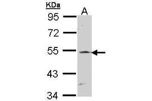 WB Image Sample (30 ug of whole cell lysate) A: Raji 7. (RBPJ anticorps)