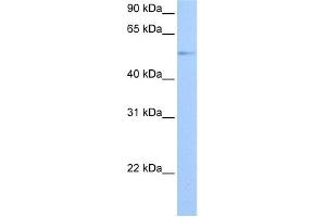 WB Suggested Anti-GRK4 Antibody Titration: 0. (GRK4 anticorps  (Middle Region))