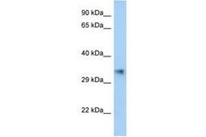 Image no. 1 for anti-Aldo-Keto Reductase Family 1, Member E2 (AKR1E2) (C-Term) antibody (ABIN6747366) (AKR1E2 anticorps  (C-Term))