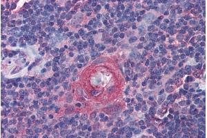 ABIN570765 (3. (ICOS anticorps  (Internal Region))