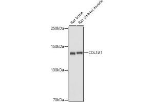 Western blot analysis of extracts of various cell lines, using Collagen I/COL1 antibody (6891) at 1:2680 dilution. (COL1A1 anticorps)