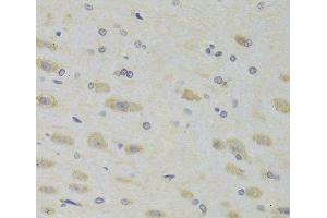 Immunohistochemistry of paraffin-embedded Rat brain using RPL9 Polyclonal Antibody at dilution of 1:100 (40x lens).