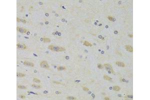 Immunohistochemistry of paraffin-embedded Rat brain using RPL9 Polyclonal Antibody at dilution of 1:100 (40x lens). (RPL9 anticorps)