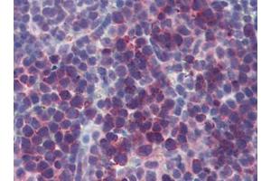 Mouse Spleen (formalin-fixed, paraffin-embedded) stained with TSLPfollowed by biotinylated goat anti-rabbit IgG secondary antibody, alkaline phosphatase-streptavidin and chromogen. (Thymic Stromal Lymphopoietin anticorps)