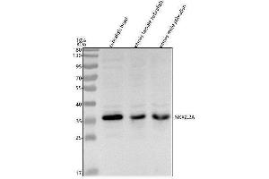 Western blot analysis of NKX2.