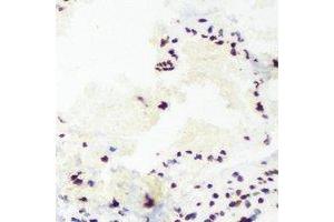 Immunohistochemical analysis of TAFI110 staining in mouse lung formalin fixed paraffin embedded tissue section. (TAF1C anticorps)