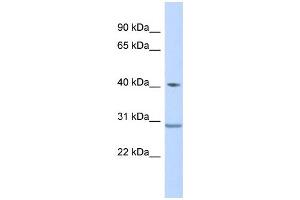 WB Suggested Anti-ZNF396 Antibody Titration:  0. (ZNF396 anticorps  (Middle Region))