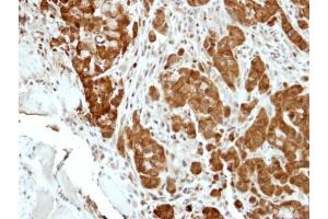 IHC-P Image Immunohistochemical analysis of paraffin-embedded A549 xenograft, using BCL2L15, antibody at 1:500 dilution. (BCL2-Like 15 anticorps)