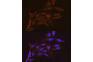 Immunofluorescence analysis of U-2 OS cells using SMC4 Rabbit mAb (ABIN7270618) at dilution of 1:100 (40x lens). (SMC4 anticorps)