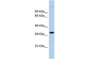 Host:  Rabbit  Target Name:  ZNF397  Sample Type:  Fetal Brain lysates  Antibody Dilution:  1. (ZNF397 anticorps  (Middle Region))