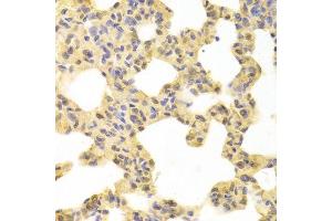 Immunohistochemistry of paraffin-embedded rat lung using MAP2K1 antibody.