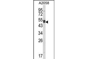 Western blot analysis of AGT3 Antibody (Center) (ABIN652630 and ABIN2842420) in  cell line lysates (35 μg/lane). (AGPAT3 anticorps  (AA 241-269))