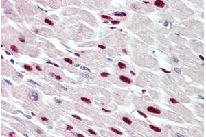 Image no. 2 for anti-THAP Domain Containing 5 (THAP5) (AA 203-252) antibody (ABIN6749756) (THAP5 anticorps  (AA 203-252))