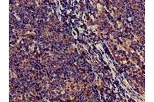 Immunohistochemistry of paraffin-embedded human lymph node tissue using ABIN7170561 at dilution of 1:100 (SAMD8 anticorps  (AA 1-152))