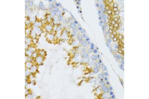 Immunohistochemistry of paraffin-embedded mouse testis using PTN Antibody (ABIN3017413, ABIN3017414, ABIN1682388 and ABIN6220085) at dilution of 1:100 (40x lens). (Pleiotrophin anticorps)