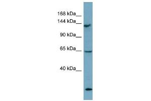 LATS1 antibody used at 1 ug/ml to detect target protein. (LATS1 anticorps)