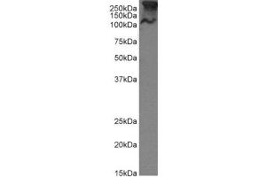 Western Blot using anti-MUC1 antibody SM3  MCF-7 cell lysate (35 μg protein in RIPA buffer) were resolved on a 10 % SDS PAGE gel and blots probed with the chimeric rabbit version of SM3 (ABIN5668231) at 1 μg/mL before detection using an anti-rabbit secondary antibody.