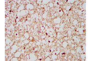 IHC image of ABIN7161257 diluted at 1:500 and staining in paraffin-embedded human brain tissue performed on a Leica BondTM system. (NCDN anticorps  (AA 403-516))