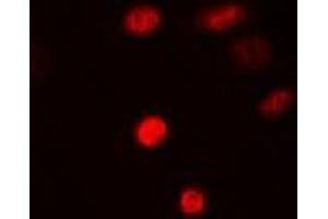 Immunofluorescent analysis of SAMHD1 staining in MCF7 cells. (SAMHD1 anticorps)